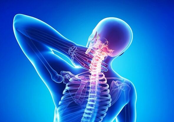 bolest v krční páteři s osteochondrózou