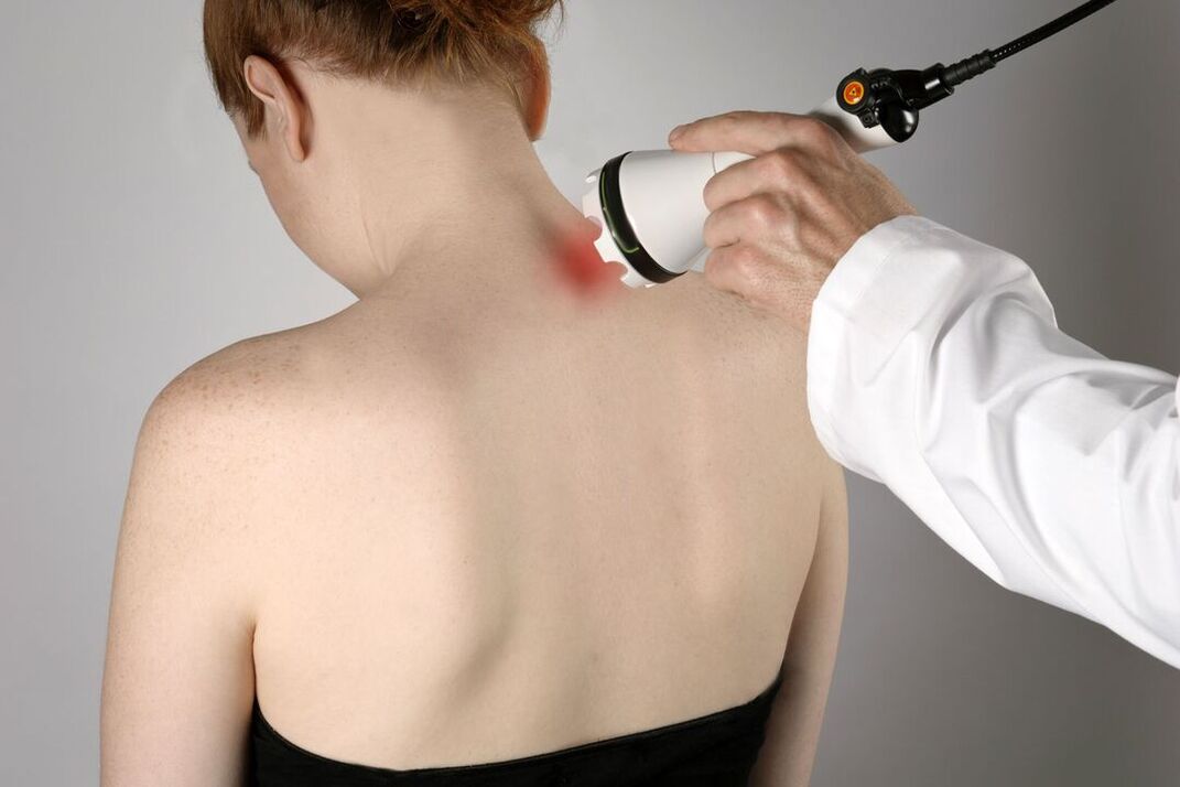 fyzioterapeutická léčba cervikální osteochondrózy